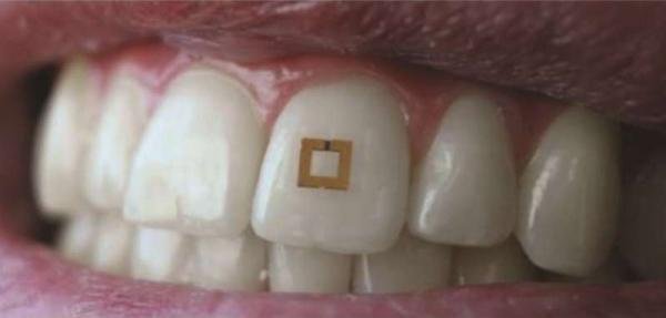 Ученые создали зубной датчик, который будет контролировать питание