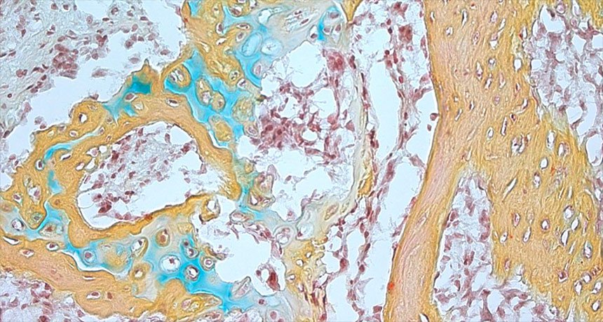 Ученые впервые идентифицировали человеческие костные стволовые клетки