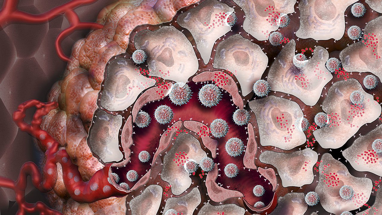 Как наноматериалы помогут в борьбе с опухолями?