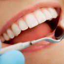 Стоматология как медицина незаменима для  всех, кто желает иметь белоснежные зубы